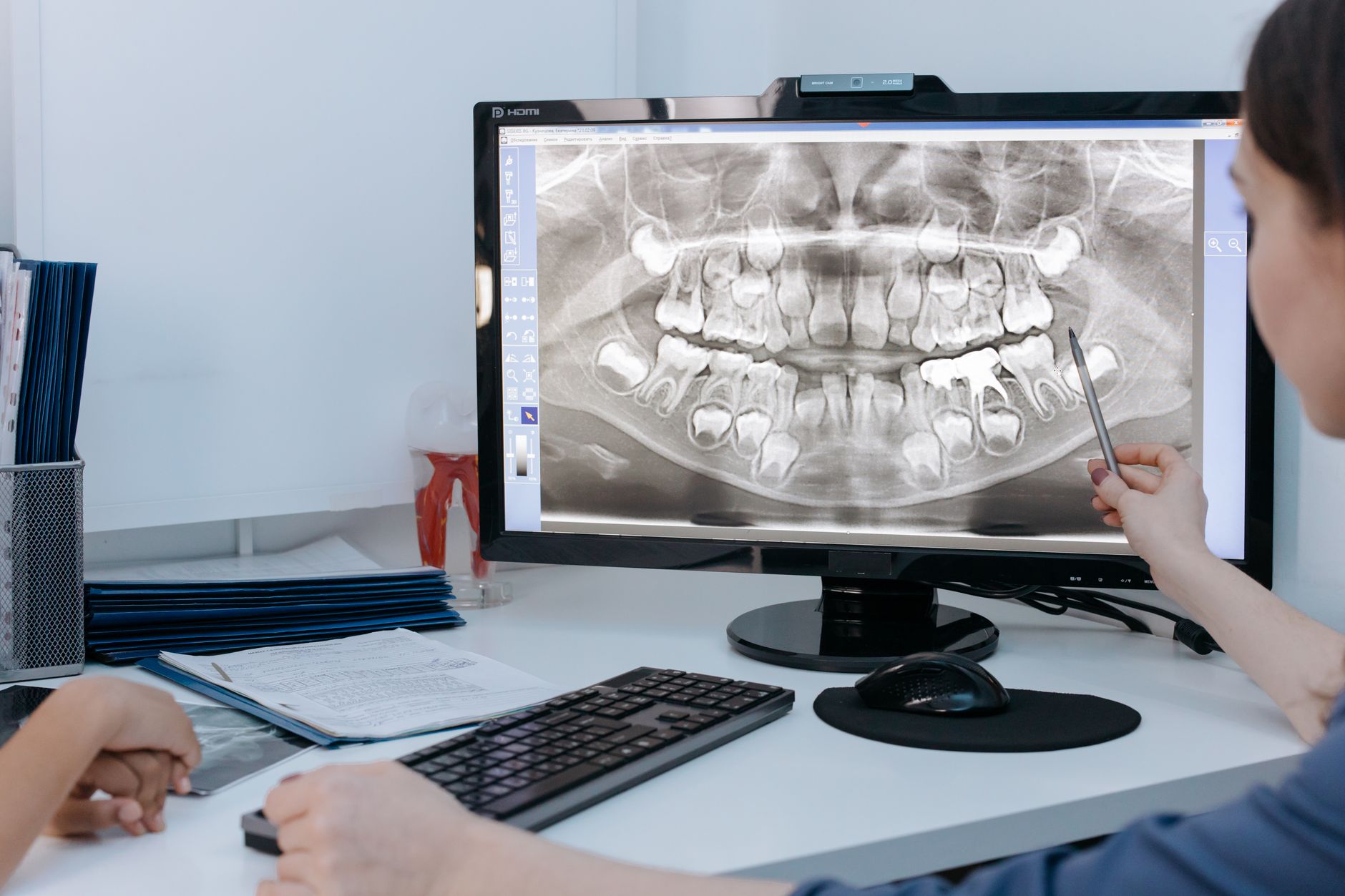 Salud dental y ortodoncia en la Clínica Dental Méndez Núñez de San Vicente del Raspeig