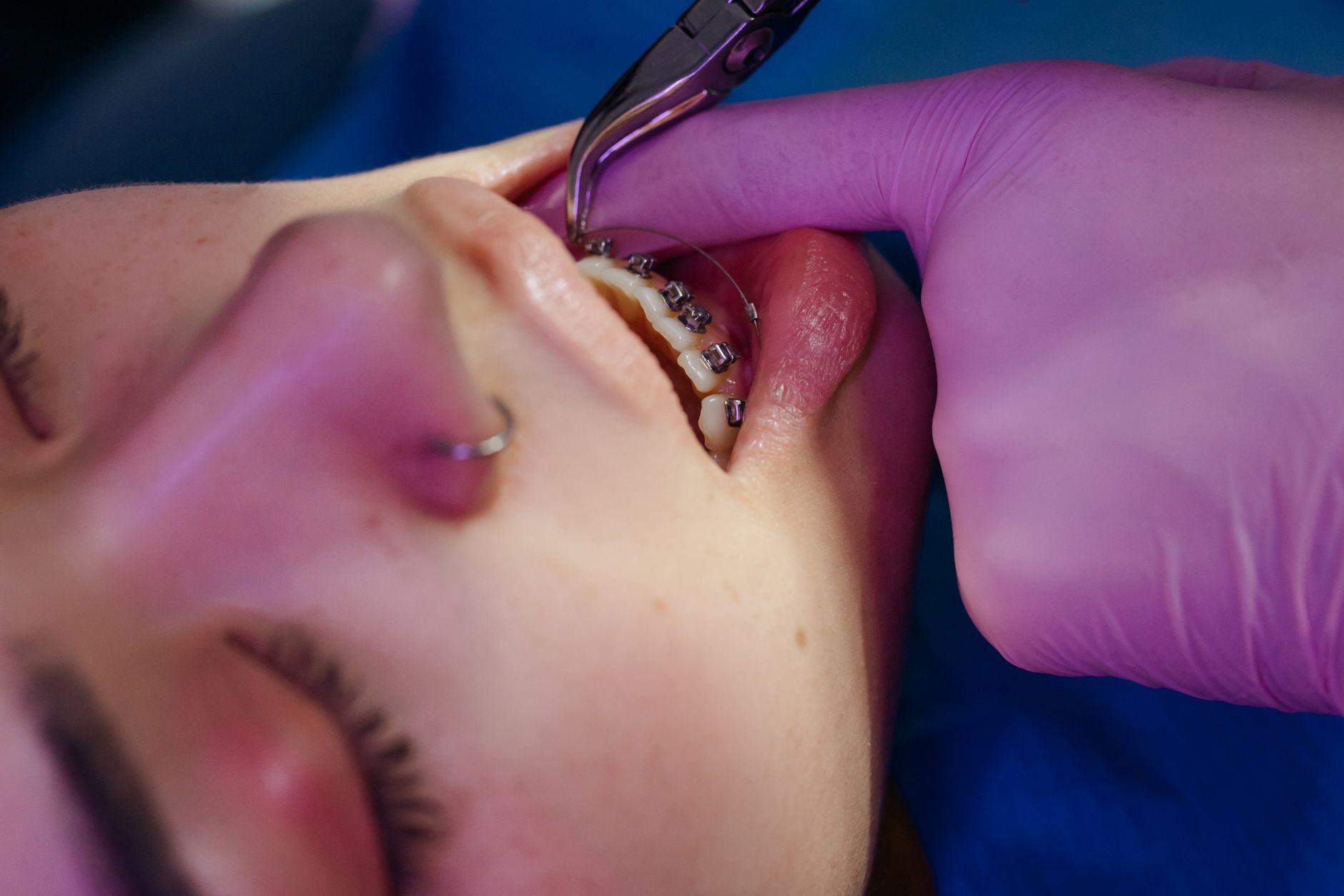 Dentix - foto 1